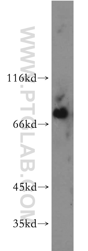 21581-1-AP;mouse spleen tissue