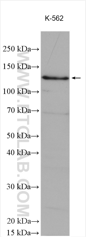 BUB1 Antibody 133301AP Proteintech