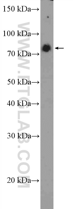 20163-1-AP;HepG2 cells