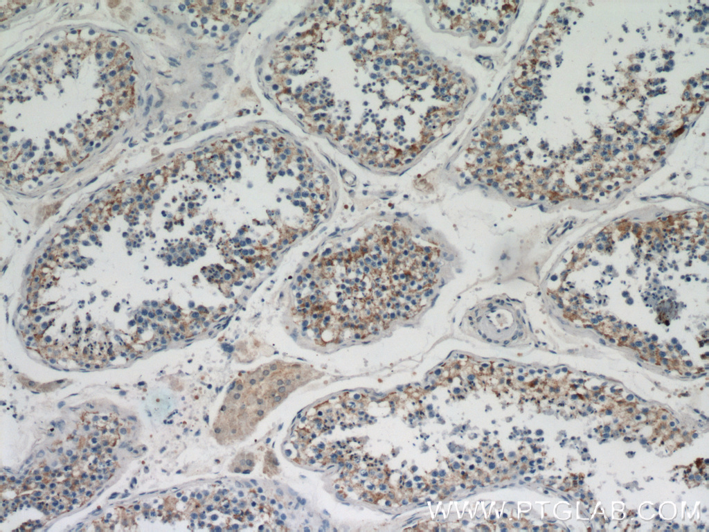 19917-1-AP;human testis