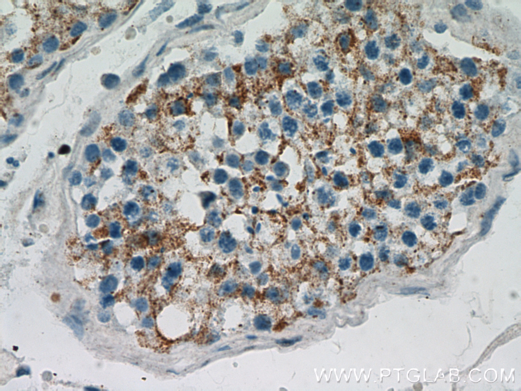 19917-1-AP;human testis