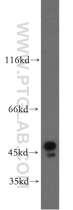 19917-1-AP;MCF7 cells
