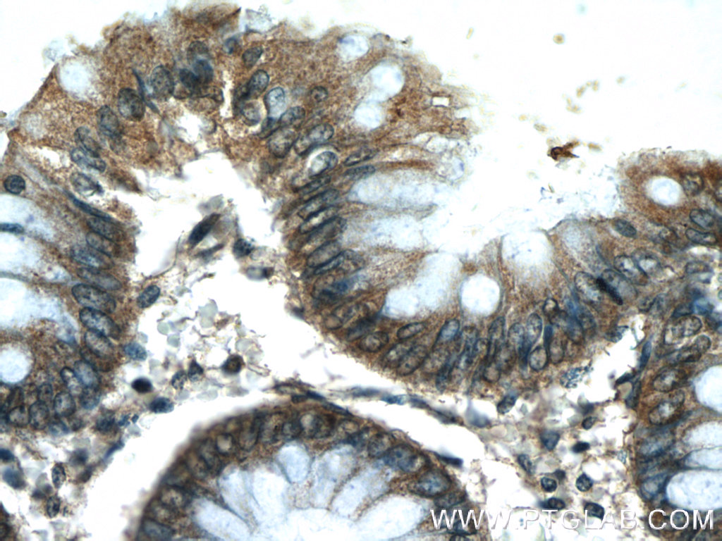 24975-1-AP;human colon tissue