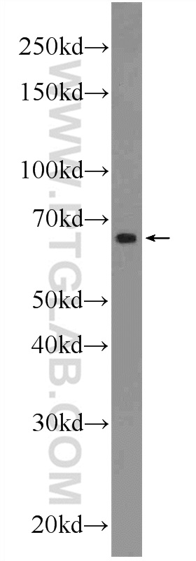 24975-1-AP;A549 cells