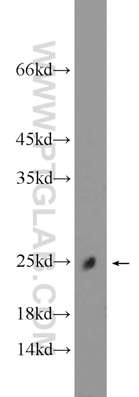 25758-1-AP;mouse skeletal muscle tissue