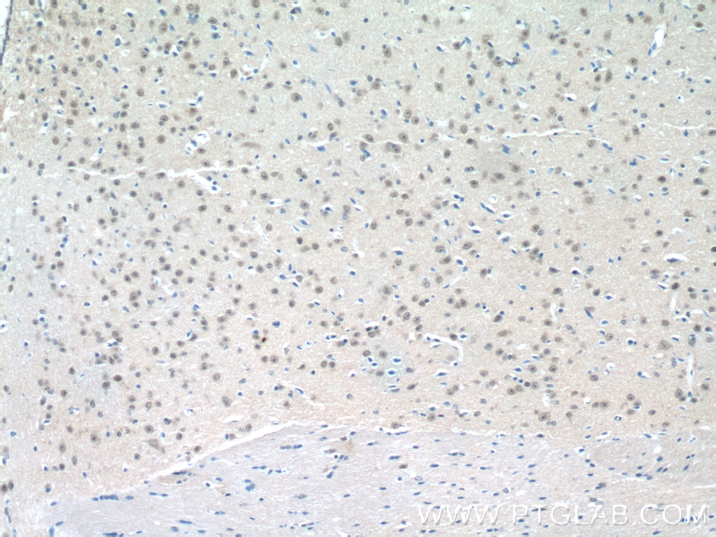 24795-1-AP;mouse brain tissue