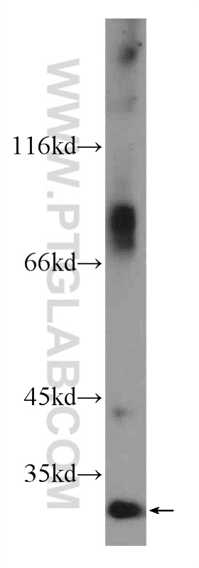 24522-1-AP;HeLa cells