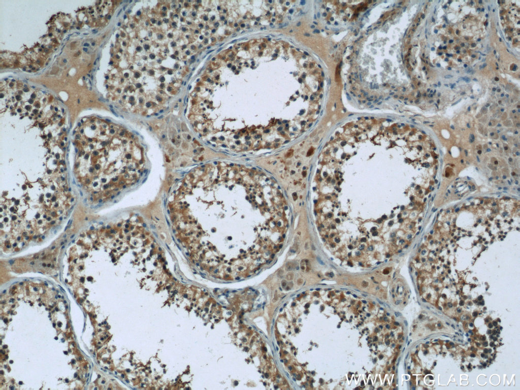 24629-1-AP;human testis tissue