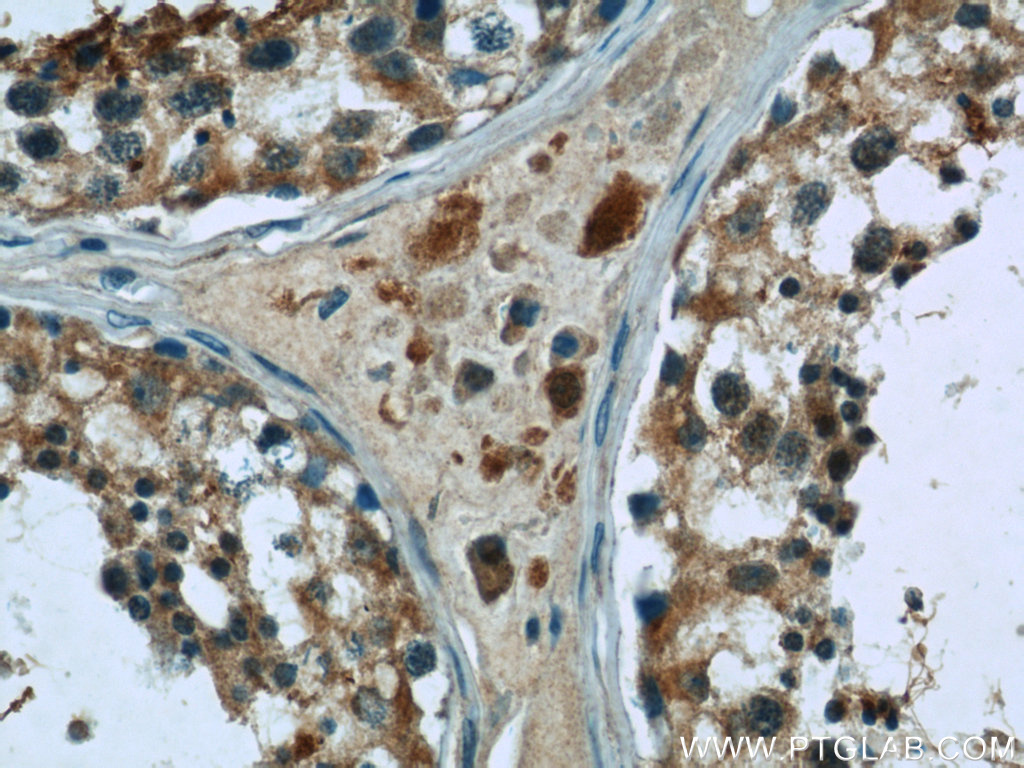 24629-1-AP;human testis tissue