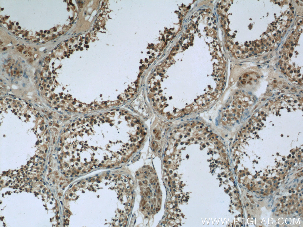 24429-1-AP;human testis tissue