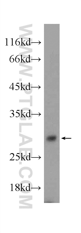 24429-1-AP;mouse testis tissue