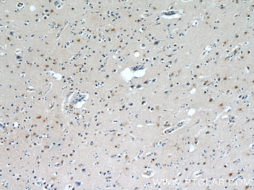 20940-1-AP;human brain
