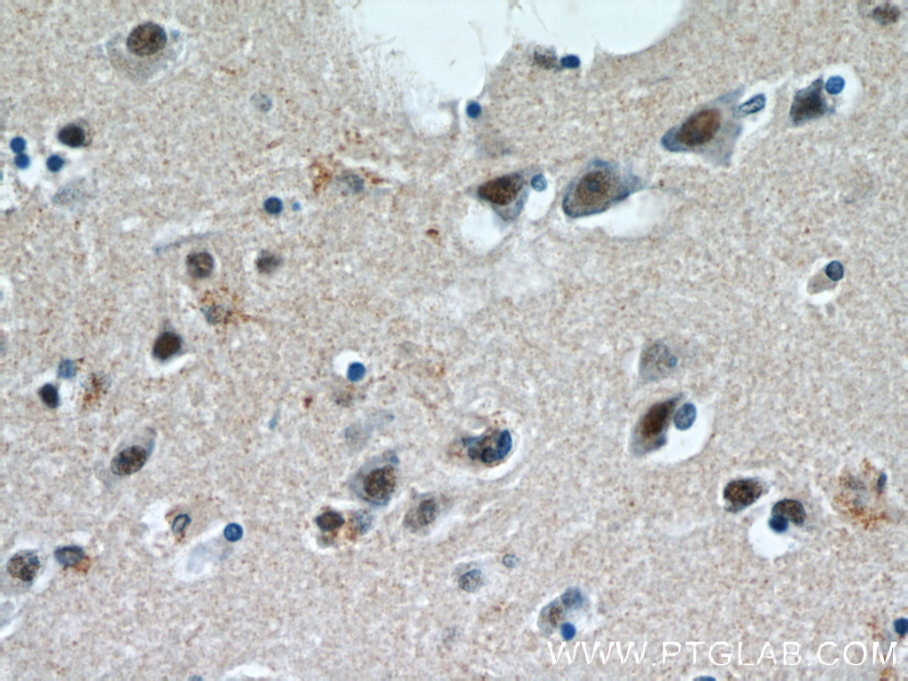 20940-1-AP;human brain