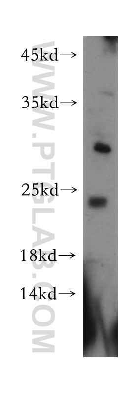 20940-1-AP;human brain tissue