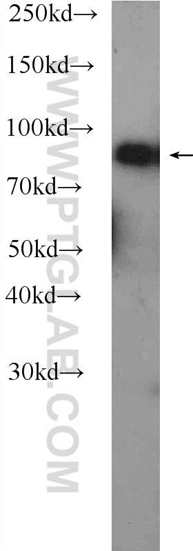 22233-1-AP;human blood tissue
