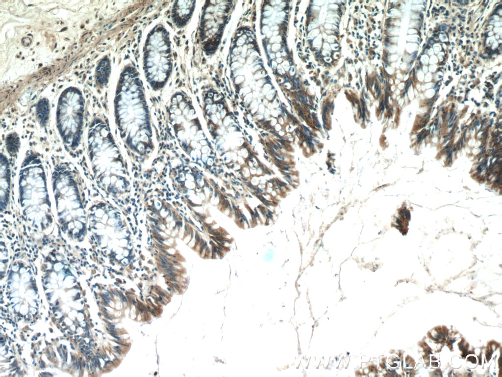25036-1-AP;human colon tissue