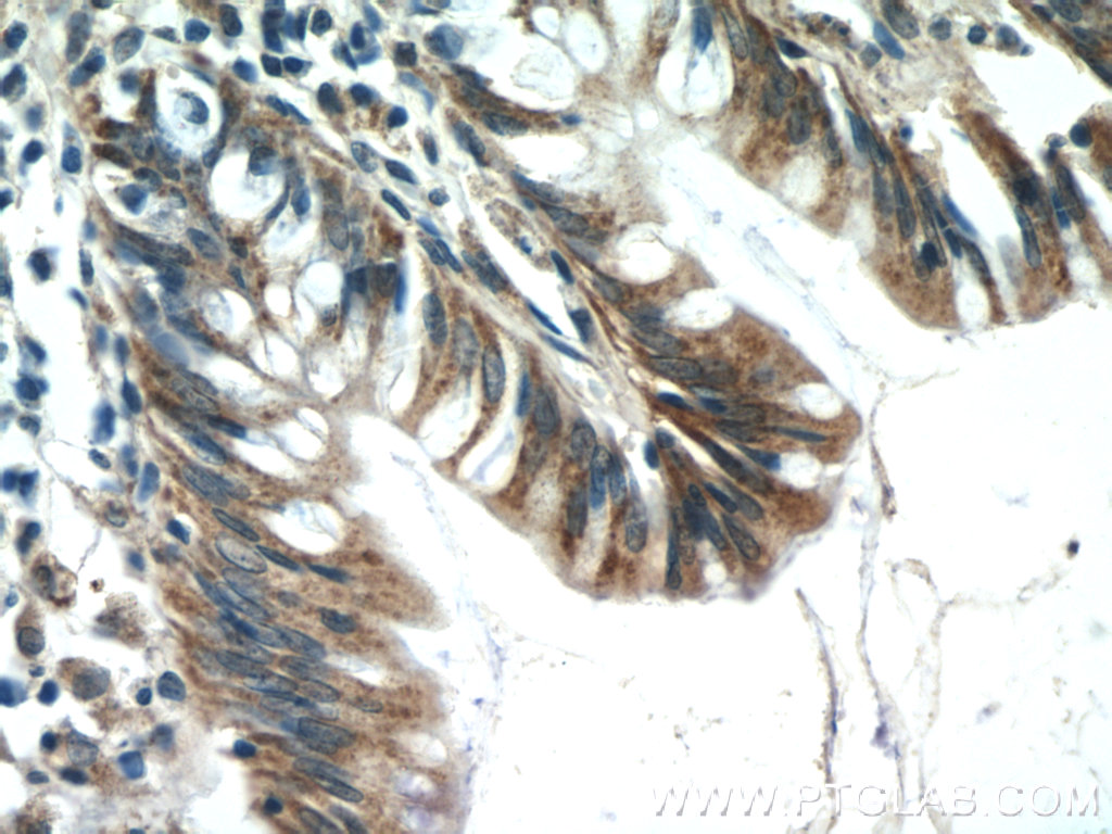25036-1-AP;human colon tissue