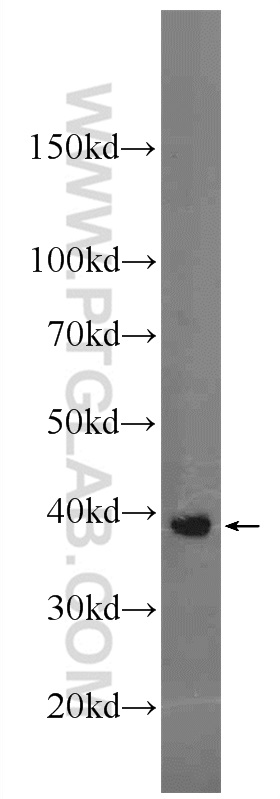 22569-1-AP;SKOV-3 cells