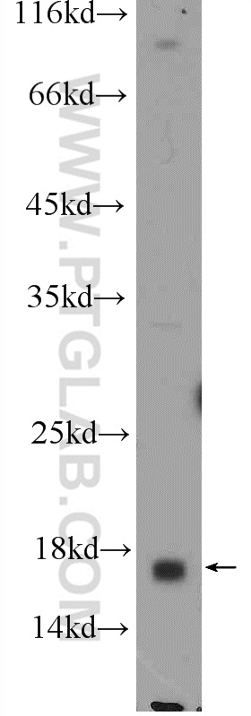 25249-1-AP;PC-3 cells