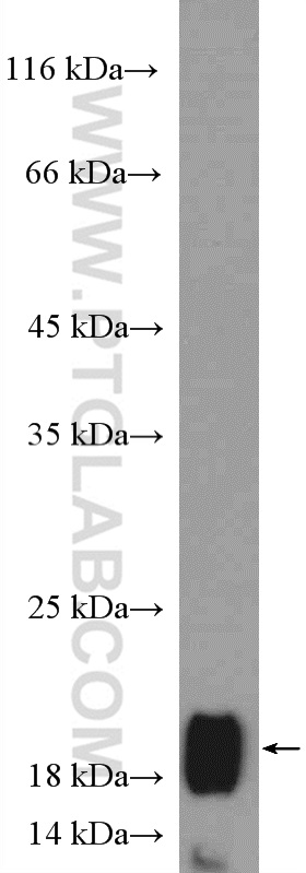 26101-1-AP;A431 cells