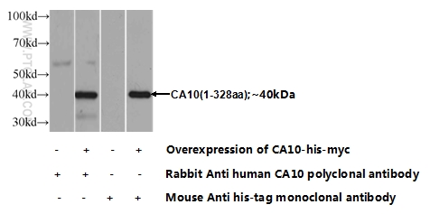 12953-1-AP;Transfected HEK-293 cells