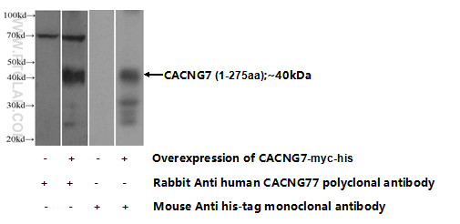 17862-1-AP;Transfected HEK-293 cells