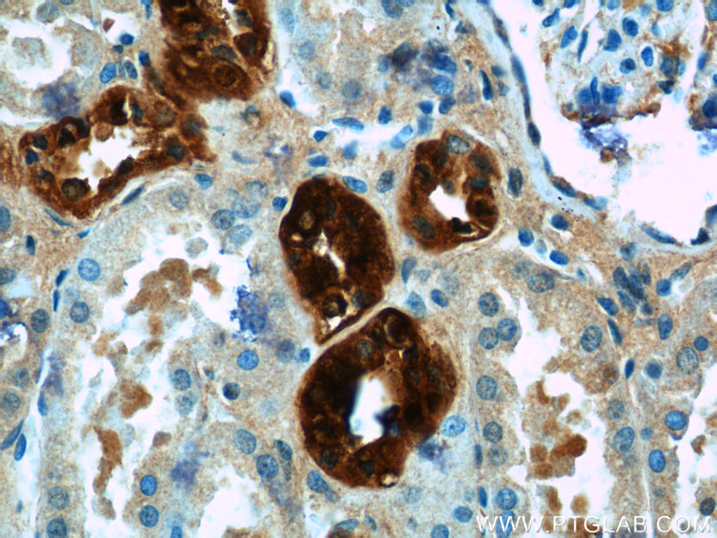 14479-1-AP;human kidney tissue