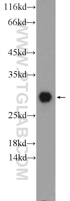 14479-1-AP;mouse brain tissue