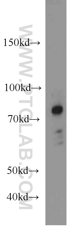 20887-1-AP;mouse small intestine tissue