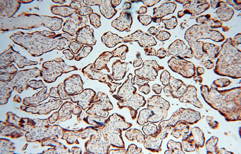17804-1-AP;human placenta