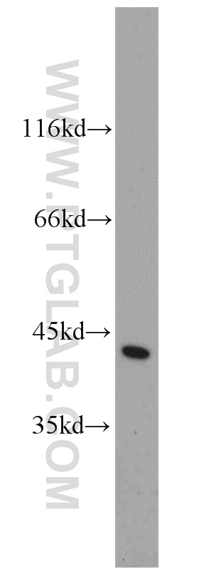10194-1-AP;HeLa cell