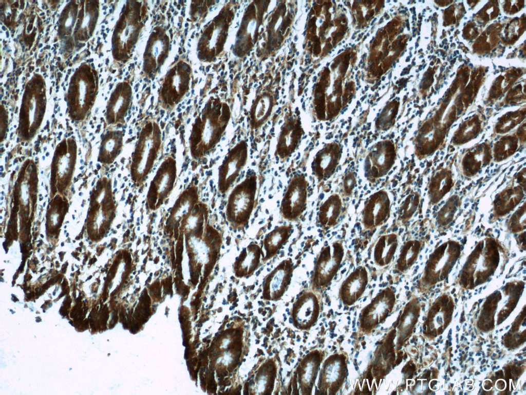 25057-1-AP;human stomach tissue