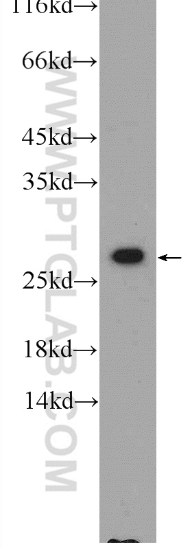 25057-1-AP;HEK-293 cells