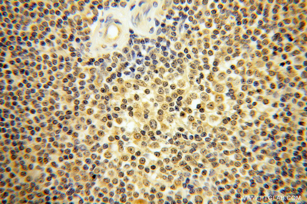 13423-1-AP;human lymphoma