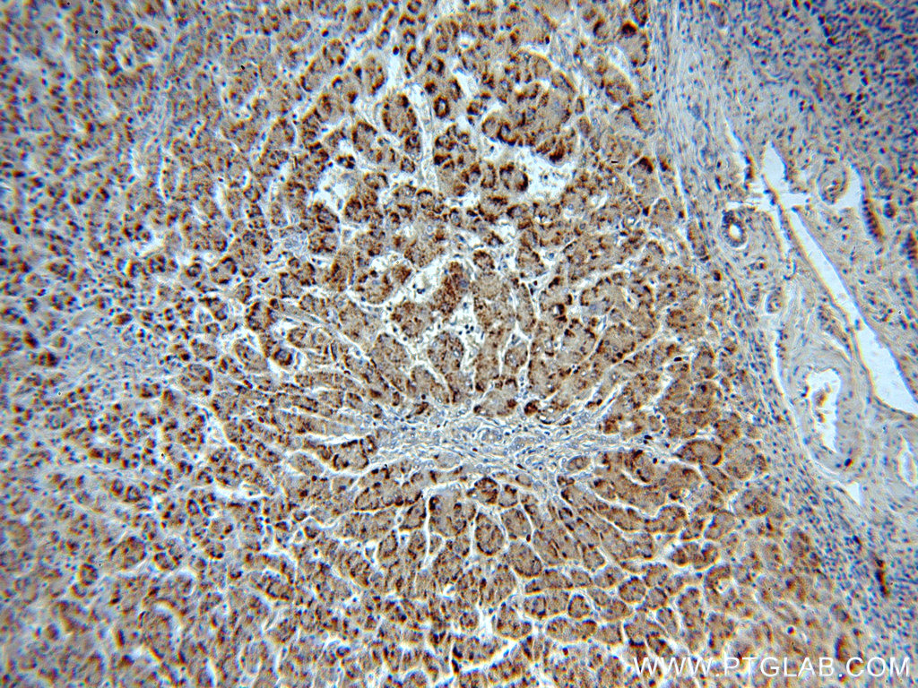 21260-1-AP;human hepatocirrhosis
