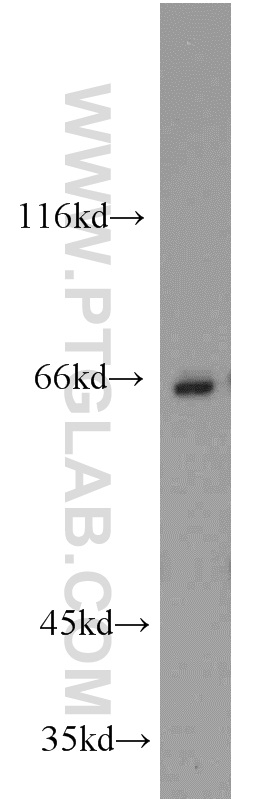 17190-1-AP;Jurkat cell