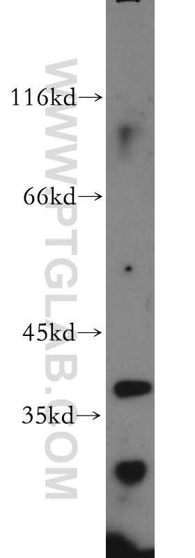 20833-1-AP;human testis tissue