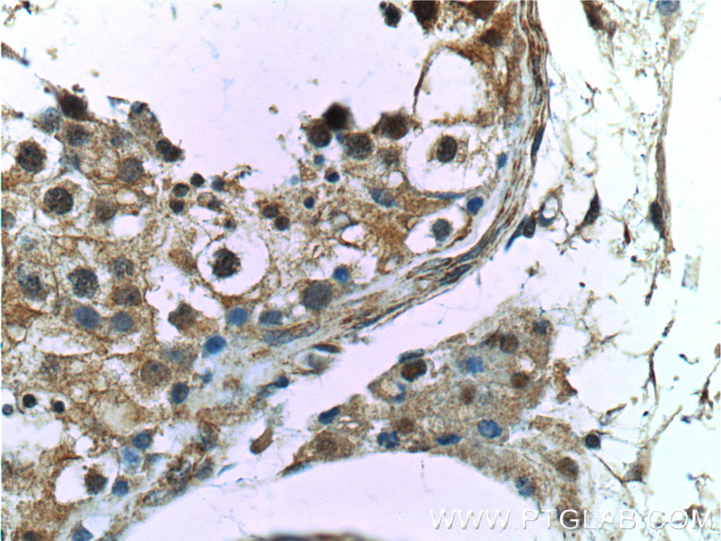 25981-1-AP;human testis tissue
