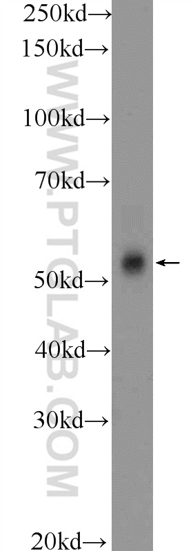 25981-1-AP;mouse testis tissue