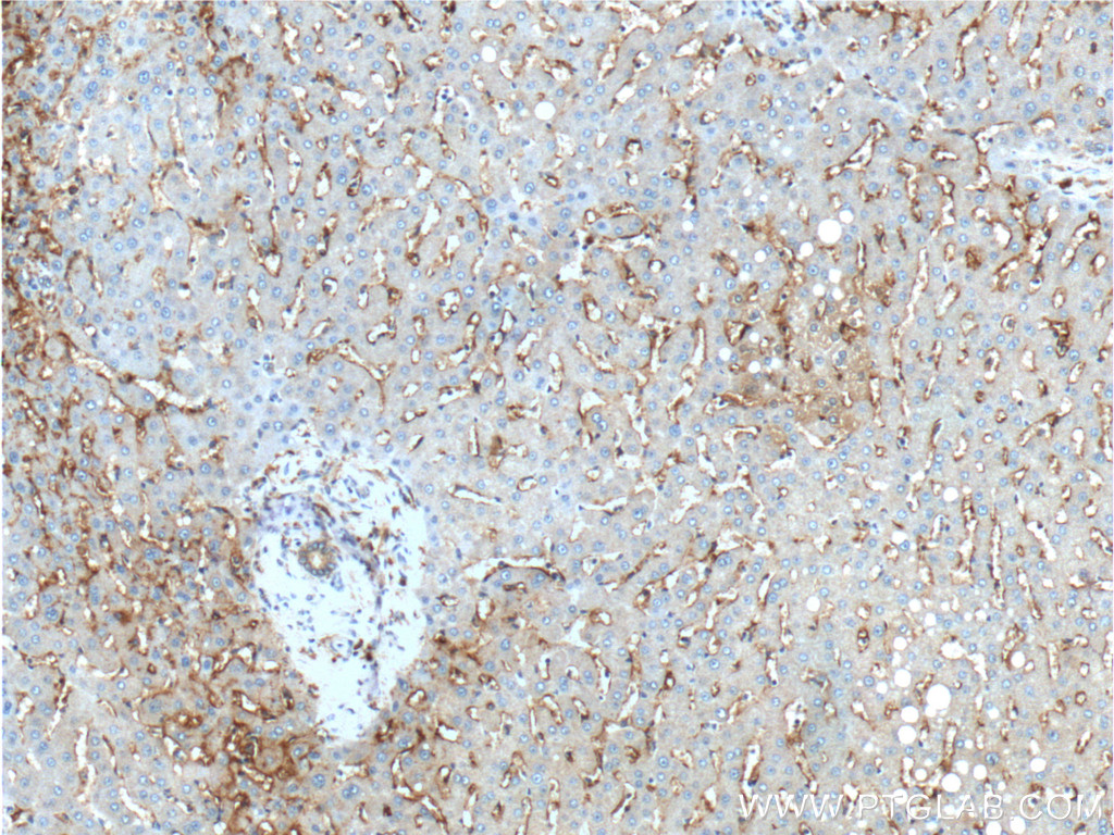 CD14 Antibody 170001AP Proteintech