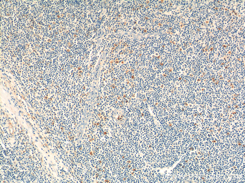 16677-1-AP;human tonsillitis tissue