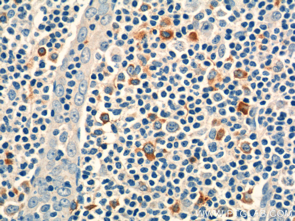 16677-1-AP;human tonsillitis tissue