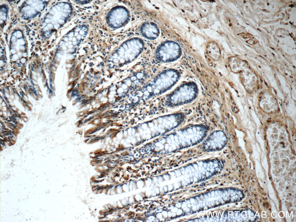 21424-1-AP;human colon tissue