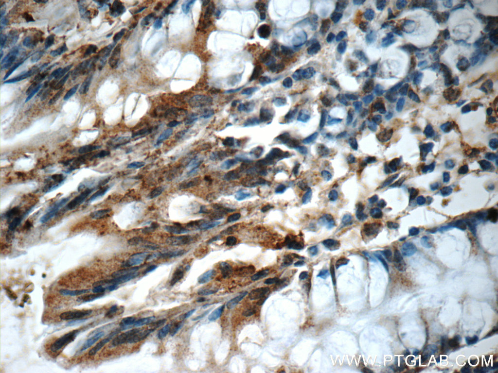 21424-1-AP;human colon tissue