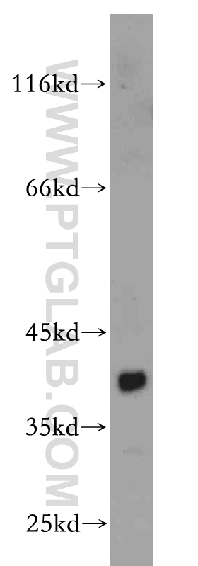 12465-1-AP;mouse kidney tissue