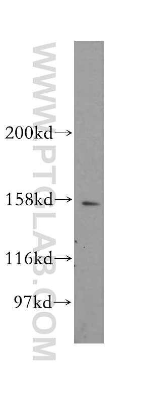 11517-1-AP;mouse testis tissue