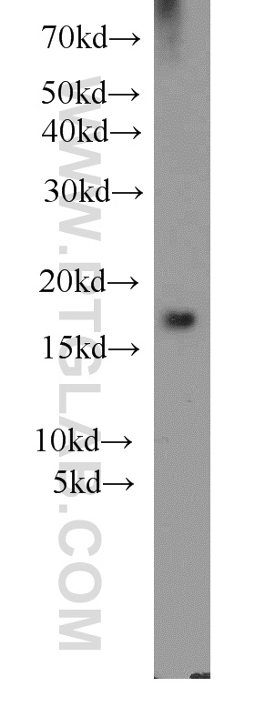 10960-1-AP;mouse brain tissue