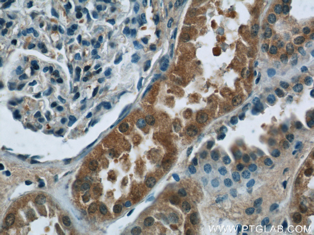 25335-1-AP;human kidney tissue