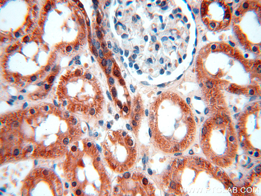 13402-1-AP;H-kidney(glomerulus)