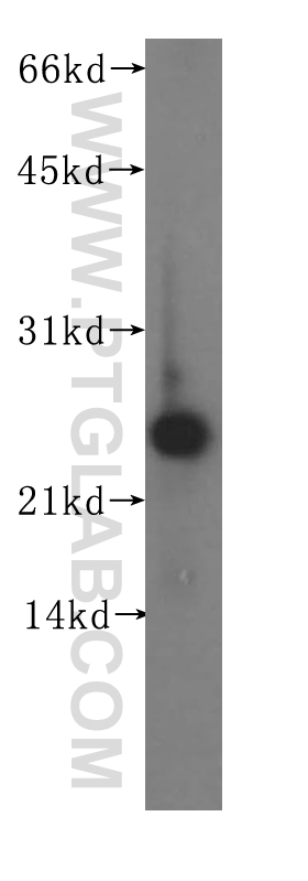11823-1-AP;human liver tissue